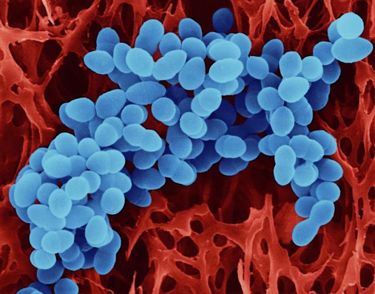 23 Staphylococcus Aureus Dennis Kunkel Microscopyscience Photo Library Ifixyouri Blog 